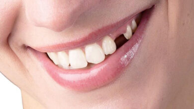 Yetişkinlerde diş kaybı giderek artıyor